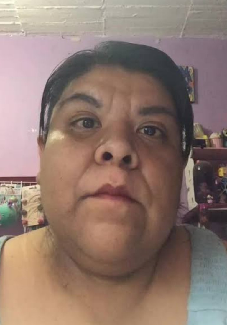 Lunar • 🍓 tweet media