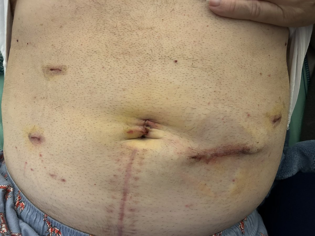 ⚡️ANDY⚡️ tweet media