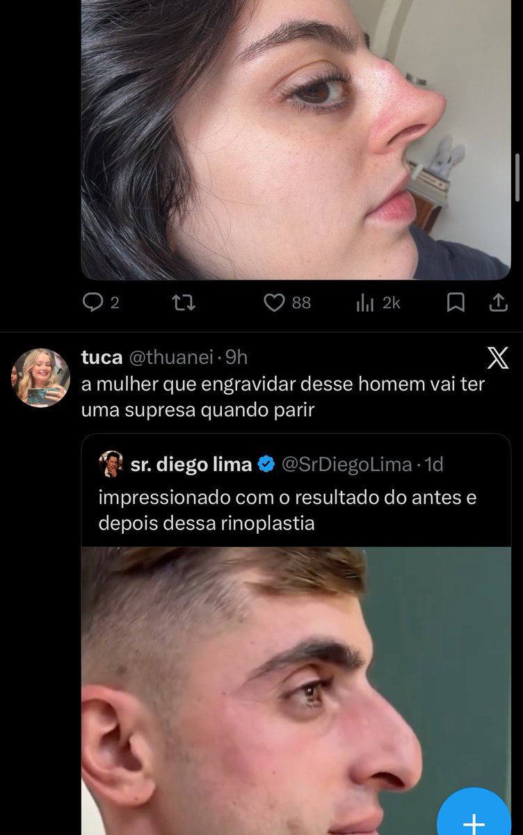 tio pity tweet media