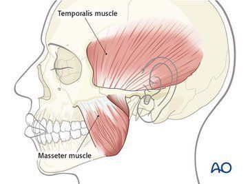 LoreCardenasX's tweet photo. Por favor, hazte un favor y relaja tus maseteros y cigomáticos oralmente.

Hay una enorme cantidad de trauma acumulado en tus músculos faciales de la que no te habías dado cuenta. Imagina caminar masticando chicle de mástique durante varias horas al día sin masajear ni relajar nunca tus músculos maseteros.

 Los músculos de la mandíbula son una de las partes más fuertes del cuerpo humano. Están unidos a la sien, lo que puede ser la razón por la que experimentas dolores de cabeza. 

Si los músculos faciales están tensos, incluso pueden tirar de la cara hacia atrás como mecanismo de proyección. 
Relaja tus músculos temporales con los nudillos y masajea tus maseteros durante 5 minutos cada uno.