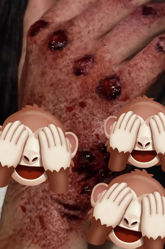 mafin_arg's tweet image. Fue semana intensa de grabación y muchas cositas se vienen dentro de 100 capítulos!!!!

Pd/ si asi le quedó la mano a la maquilladora,no me quiero imaginar como terminó el personaje...🙊

#Backstage efectos especiales y mucho más #SueñosDeLibertad 🙊