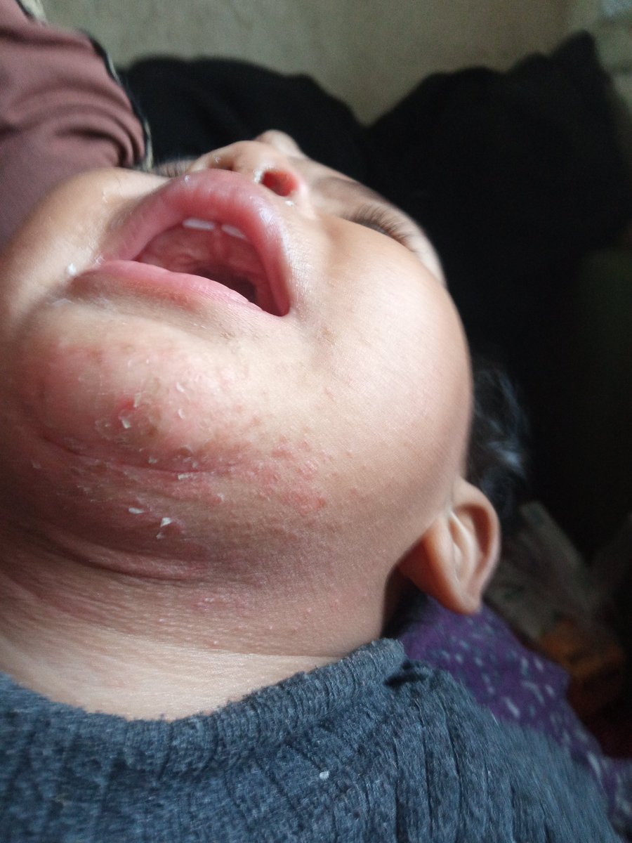 bahaa from gaza 🇵🇸 tweet media