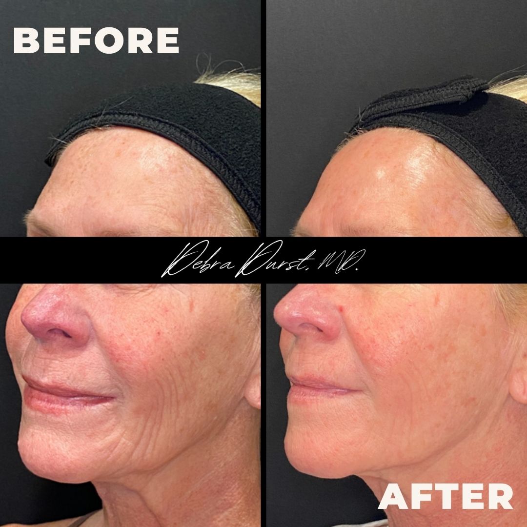 Debra Durst MD tweet media