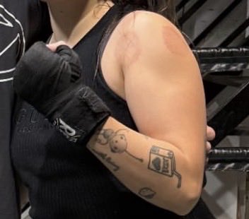 el brazo: 🖤⛓️🔪☠️🫦🔥

los tatuajes: 💕🎀🧸🧃🤏🏼
