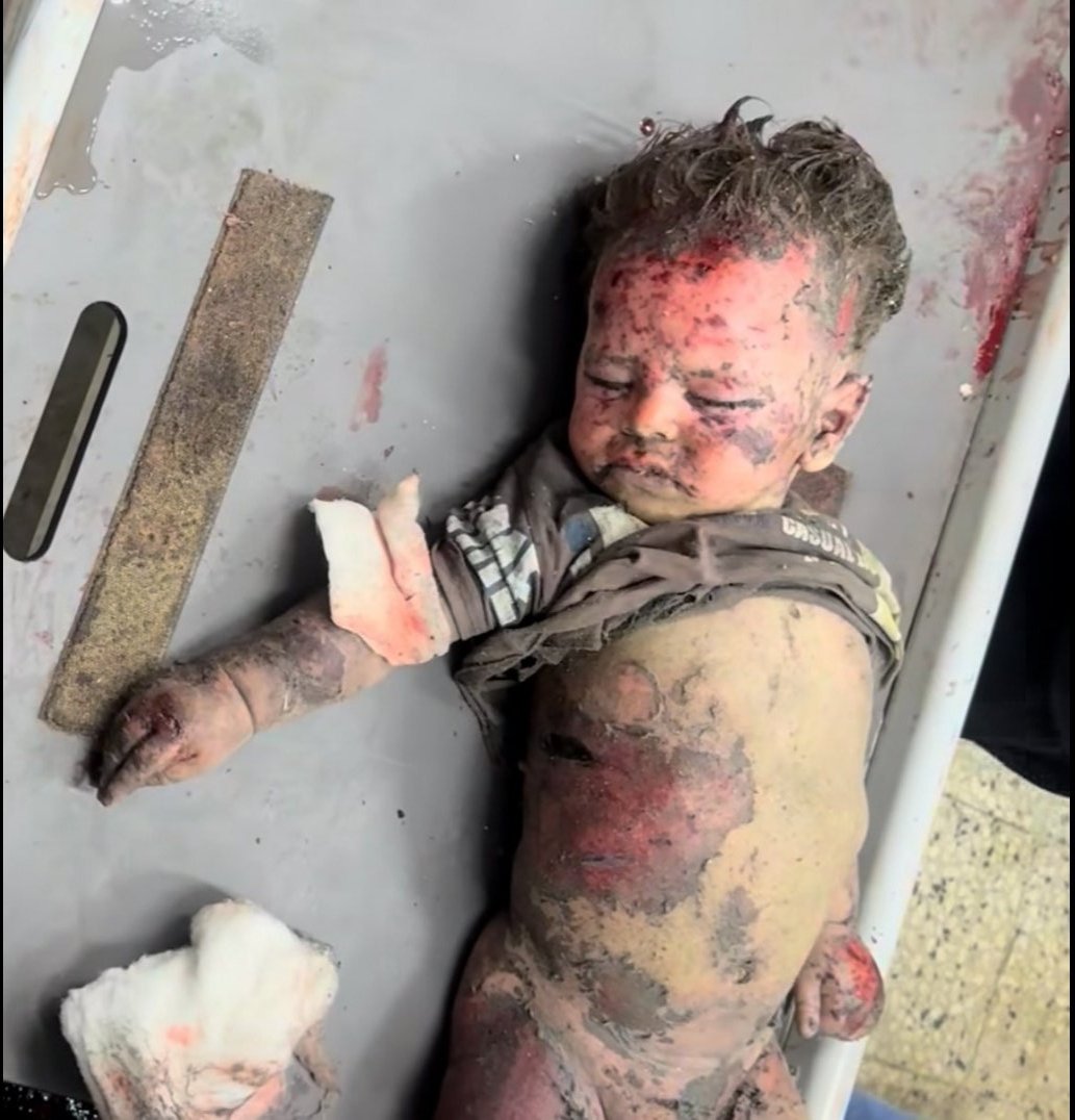 Yemen Starving tweet media