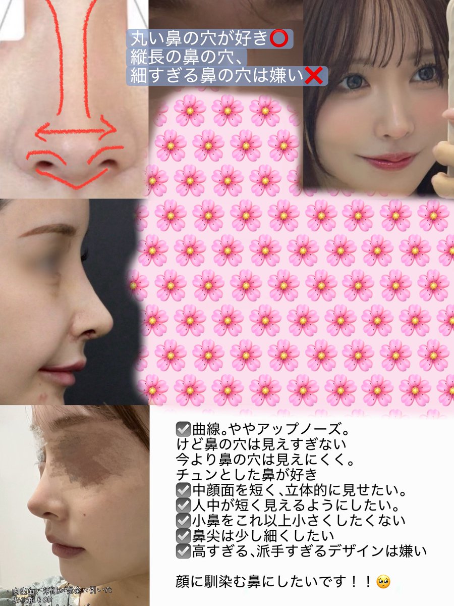 szyoon_2's tweet photo. 最終的に持って行った鼻オペ資料🌸

一般人は隠してクリニックの症例は目元にモザイクかけてます🙃 https://t.co/2yeYjPA8V2