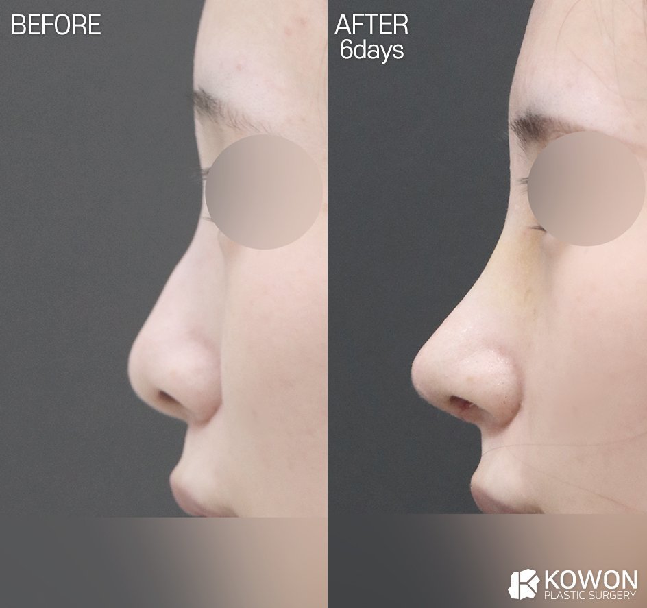 Dr.KimHT (コウォン整形外科) tweet media