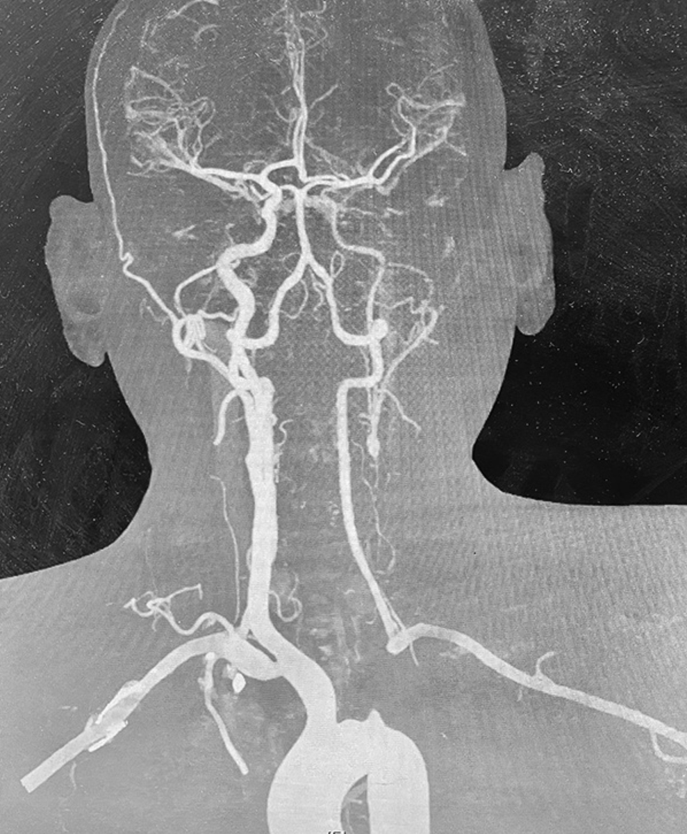 Annals of Indian Academy of Neurology tweet media