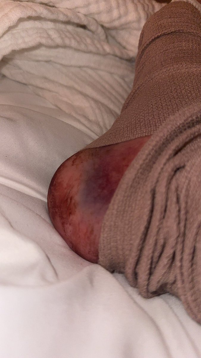 Stanley “Stillborn” Mcgreg tweet media