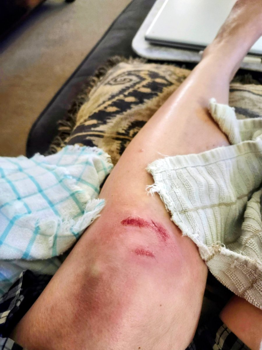 GigiisTx1968's tweet image. My son said I fell like an old lady because it was slow motion!🤣
Meanwhile I was like:
"Where am I going?"
"Can I save it?"
"Nope."
"Okay, we’re eating pavement."
Can bear weight but tomorrow should be fun! 🤣 #aging #sucks