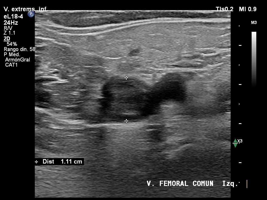 José S. Vaque Ramírez, MD tweet media