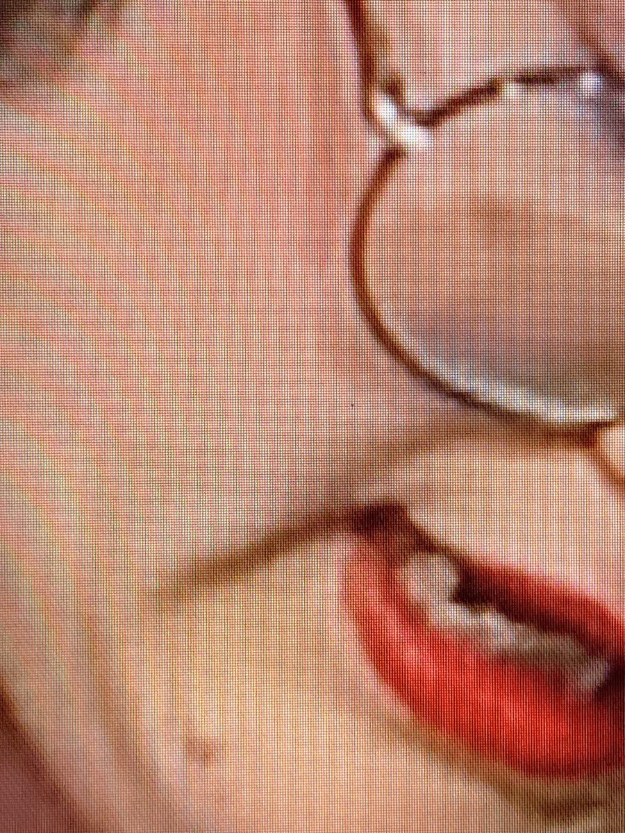 merluzo rey de los weones 🖐🏻 tweet media