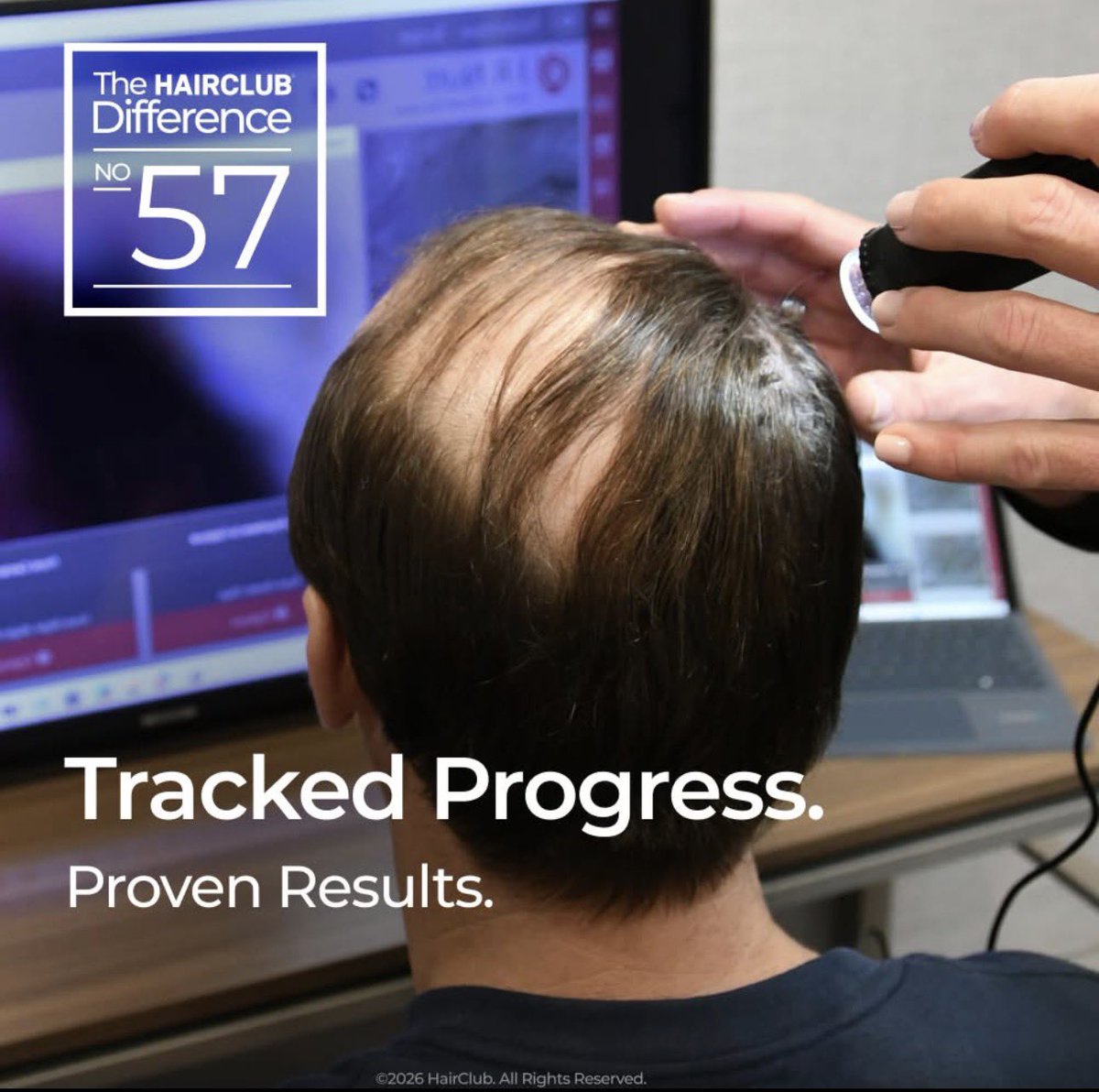 Already using a #hairtreatment? 

Bring it. 

We’ll measure your hair density and follicle health to show you objectively whether it’s working. Or not. 

Schedule your free #hairloss baseline today at one of 100+ HairClub locations across North America.

hclub.cc/4d6B06A