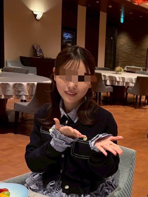 kopuccan's tweet photo. 脂肪吸引注射ってみんな知ってる？？
脂肪吸引でもなく脂肪溶解注射でもなくて、、、
わたし知らなくて教えてもらって即メーラーに脂肪吸引注射💉また絶対ジョールもやりに行く！！！！
腫れも３日くらいで落ち着いてdt短くておすすめ☺️
２枚目あふたー https://t.co/bCQgFnxZ0I