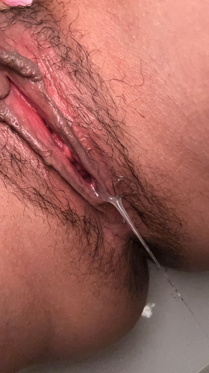 Are&AldaMID🍍 tweet media