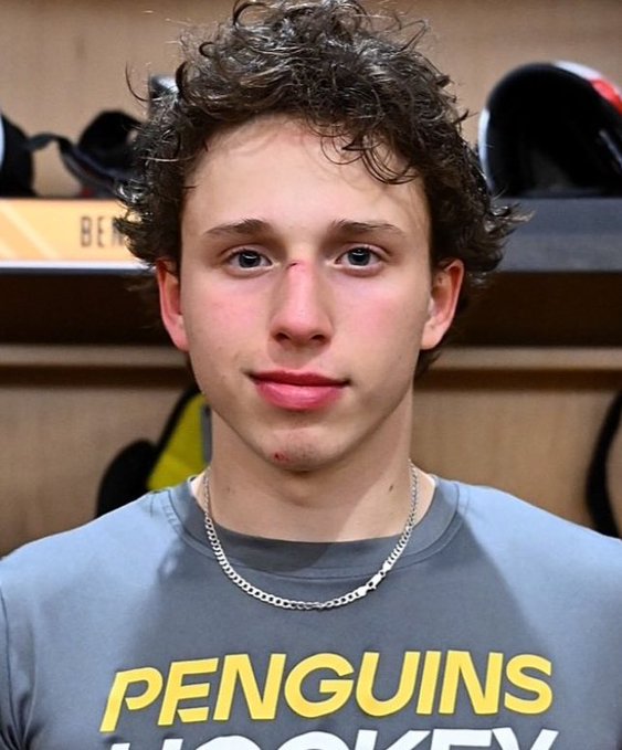 evgeni malkin's bald spot tweet media