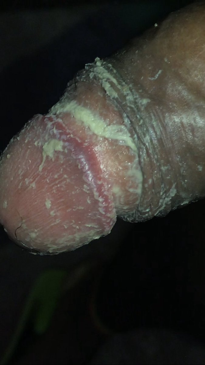 Rune ♀️🔞 🐽💦 (匚ᗪ爪乂) tweet media