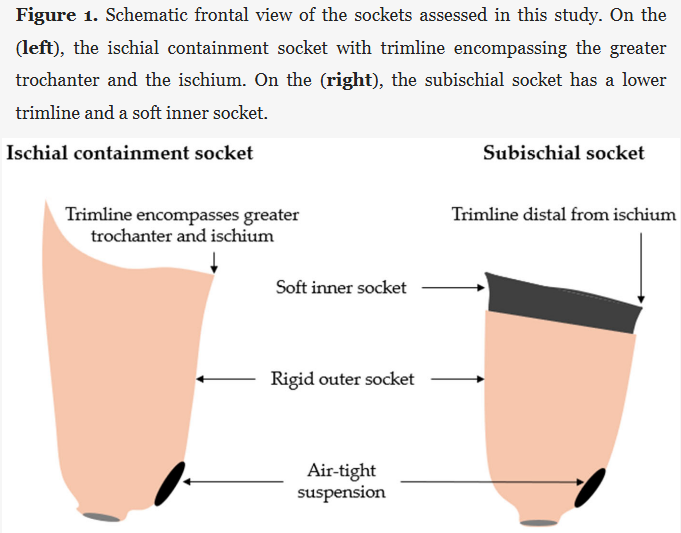 New in Prosthesis: "Subischial vs. Ischial Containment Sockets: A Multicenter Randomized Crossover Trial to Assess Comfort and Mobility in Daily Life Situations"

by Loiret et al.

🔓 #Open_Access, free to read at: brnw.ch/21x15Gg

#Prosthetics #Amputation