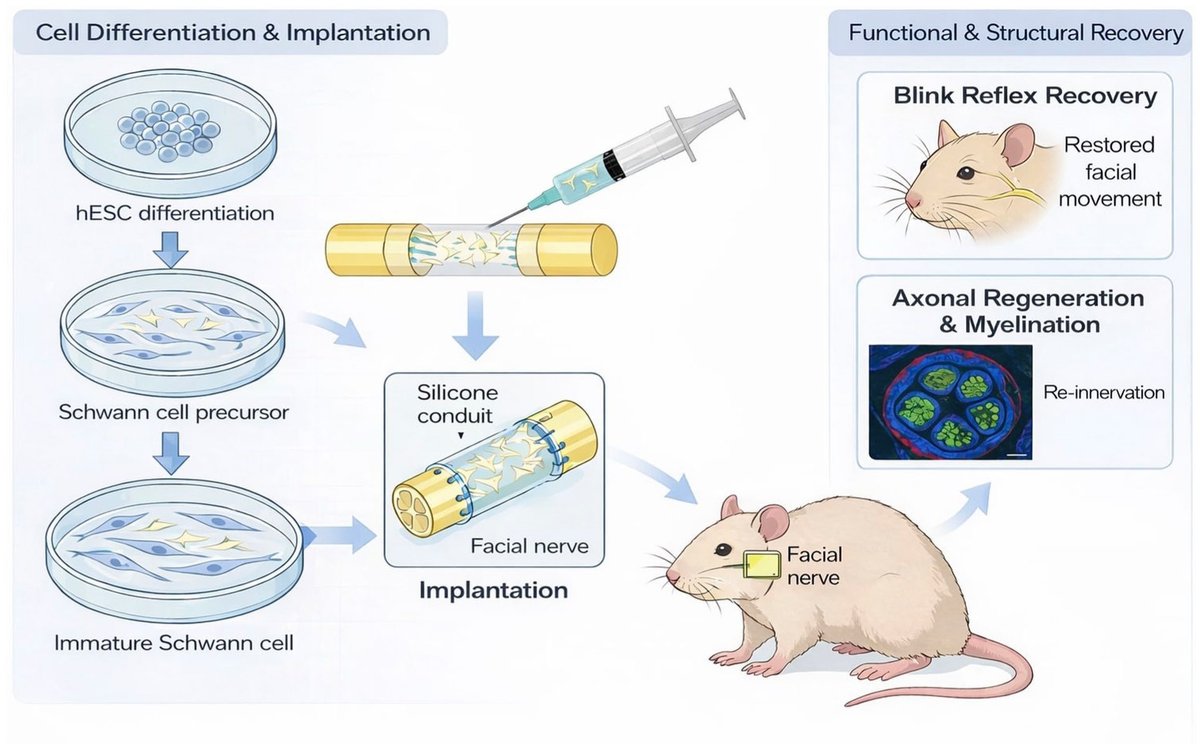 CellTransplantJ's tweet photo. Effects of human embryonic stem cell–derived Schwann cells for nerve regeneration after facial nerve injury
https://t.co/hNAu1R15qF
#stemcell #schwann #nerve #regeneration
@sagepub_japan 
@SageJournals https://t.co/0Z8LifAMML