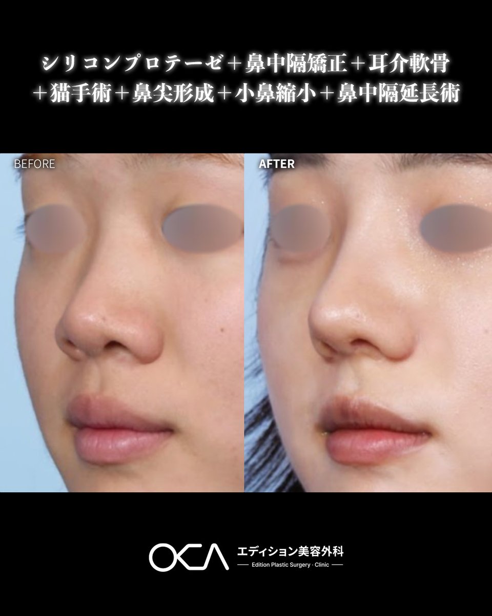 【公式】韓国エディション美容外科 tweet media