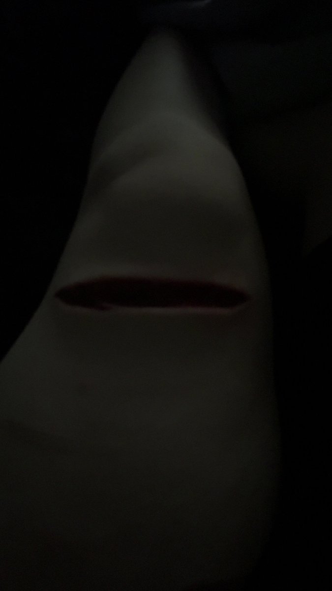 oDDity of shedtwt tweet media