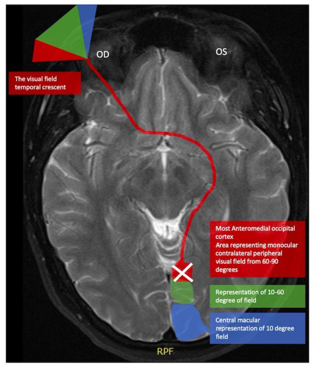 RAED ALOTAIBI tweet media