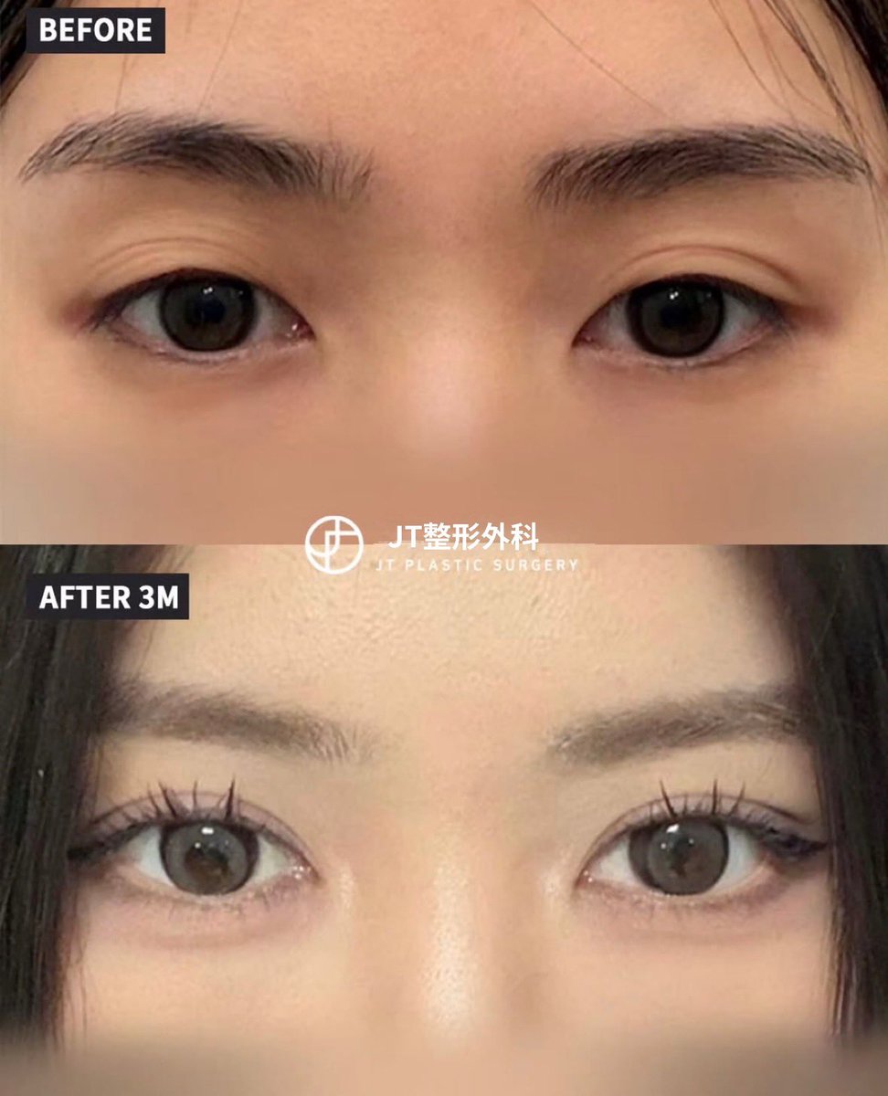 JT整形外科(輪郭・鼻・目専門) tweet media