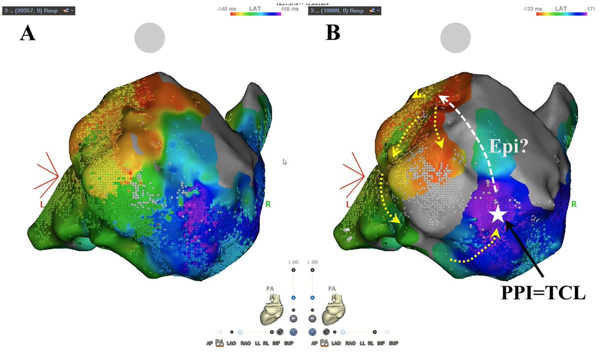 Reviews in Cardiovascular Medicine tweet media