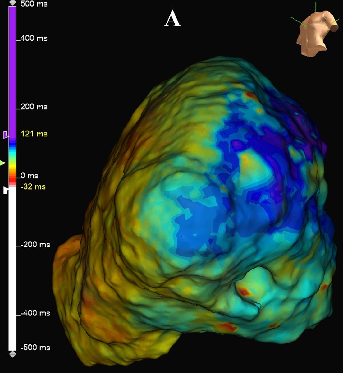 Reviews in Cardiovascular Medicine tweet media