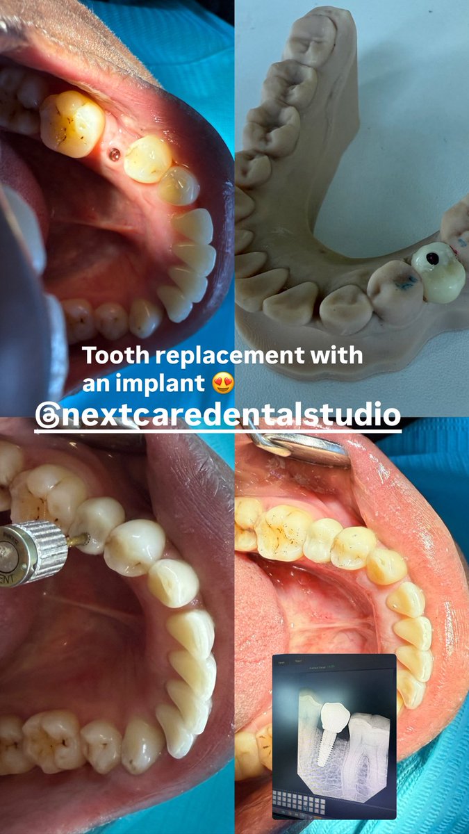 NEXTCAREDENTALSTUDIO tweet media