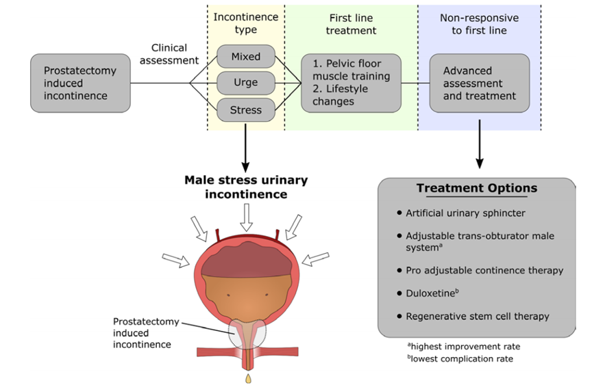 Current_Urology's tweet image. New Review in #CurrentUrology! 🔬
Which treatment offers the best balance of efficacy and safety for Male Stress Urinary Incontinence (#MSUI)? This systematic analysis of 46 studies (7,841 patients) provides the answers.
Key Findings:
🏆 Gold Standard: #AUS remains superior for