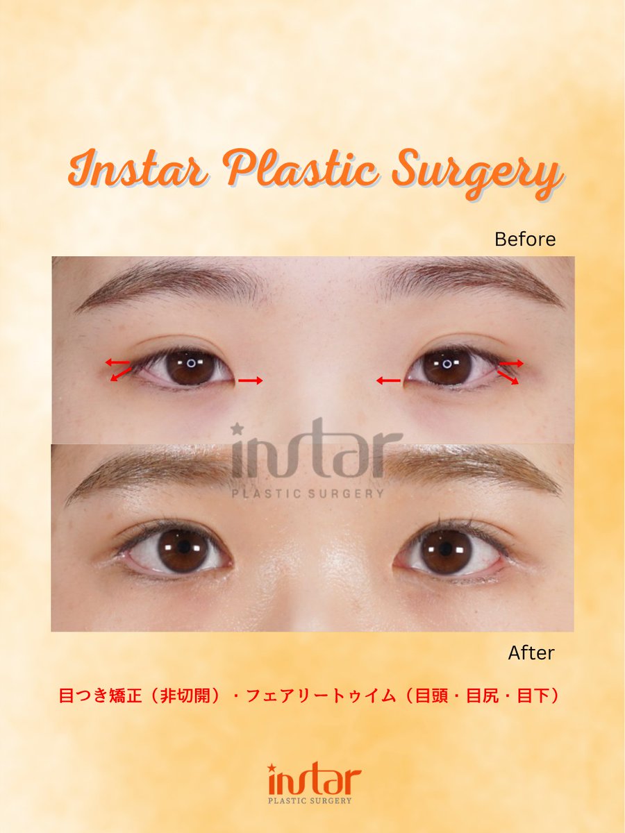 ⭐️instar整形外科⭐️ tweet media