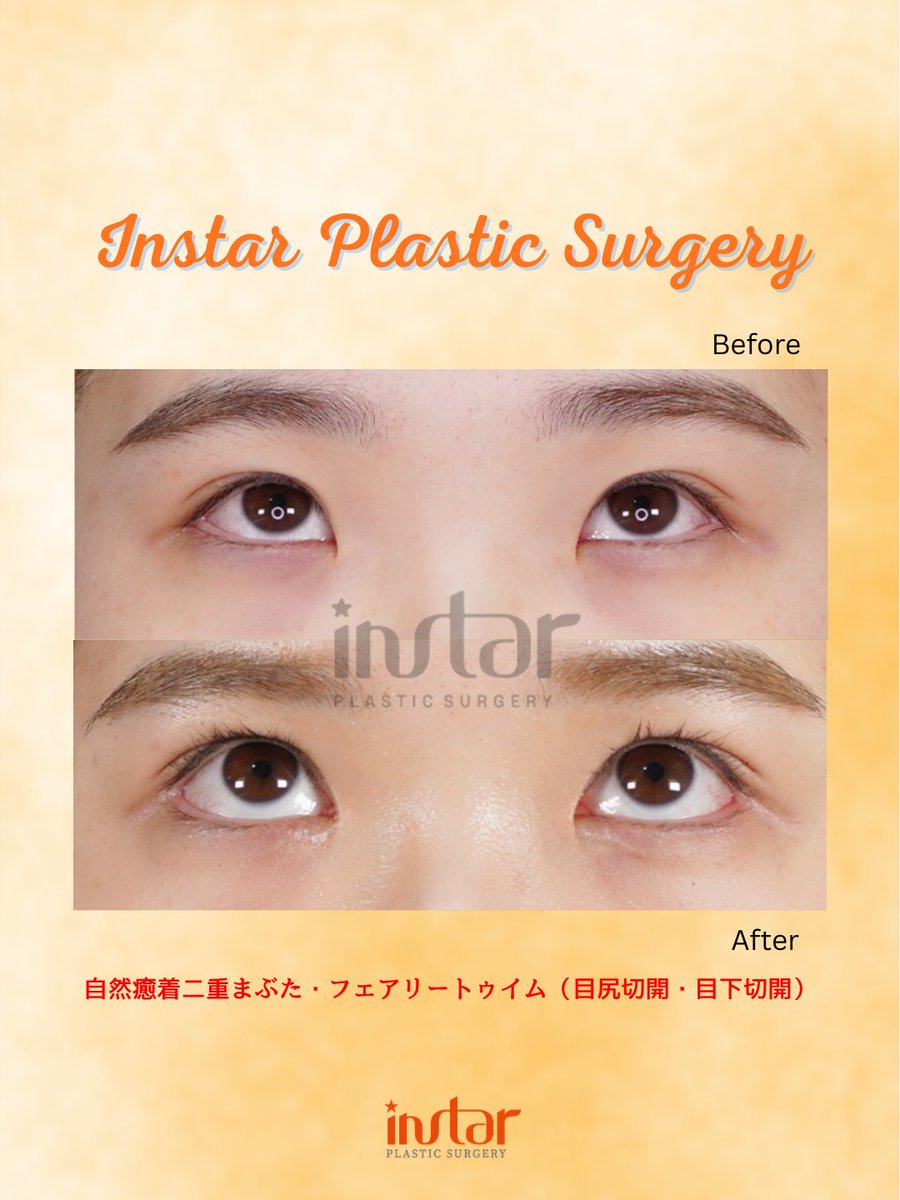 ⭐️instar整形外科⭐️ tweet media