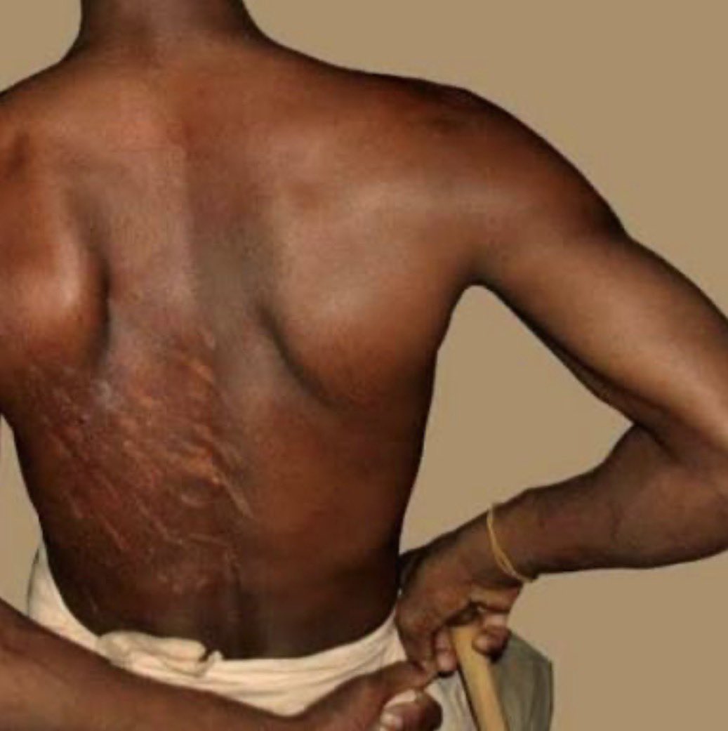 مسطل tweet media