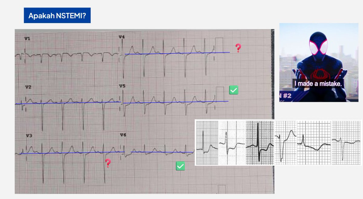 Azriel, Bluprient tweet media