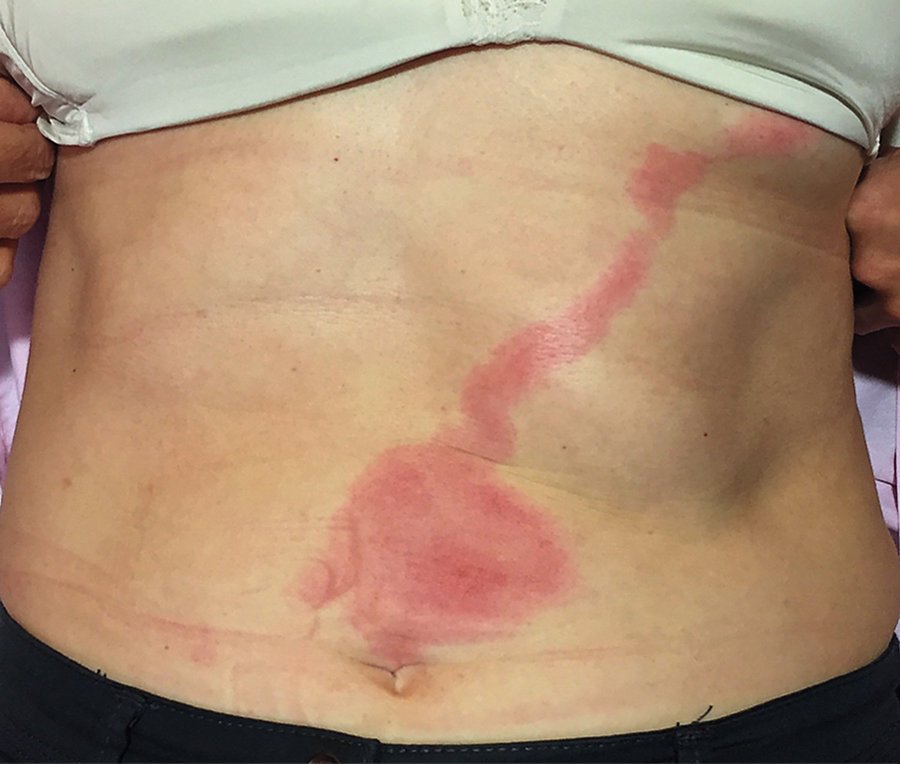 Mastering the Differential 🩺 tweet media