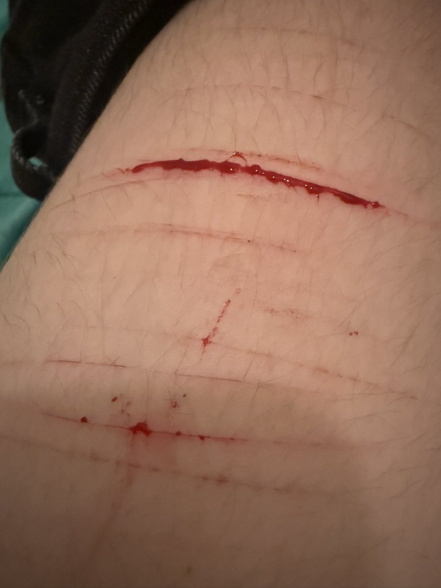 Pete Wentz of shtwt tweet media