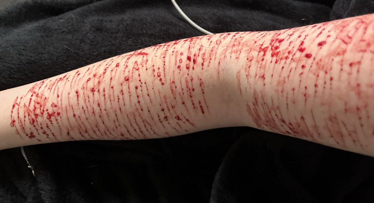 Angie || shedtwt || 𐔌՞. .՞𐦯 tweet media