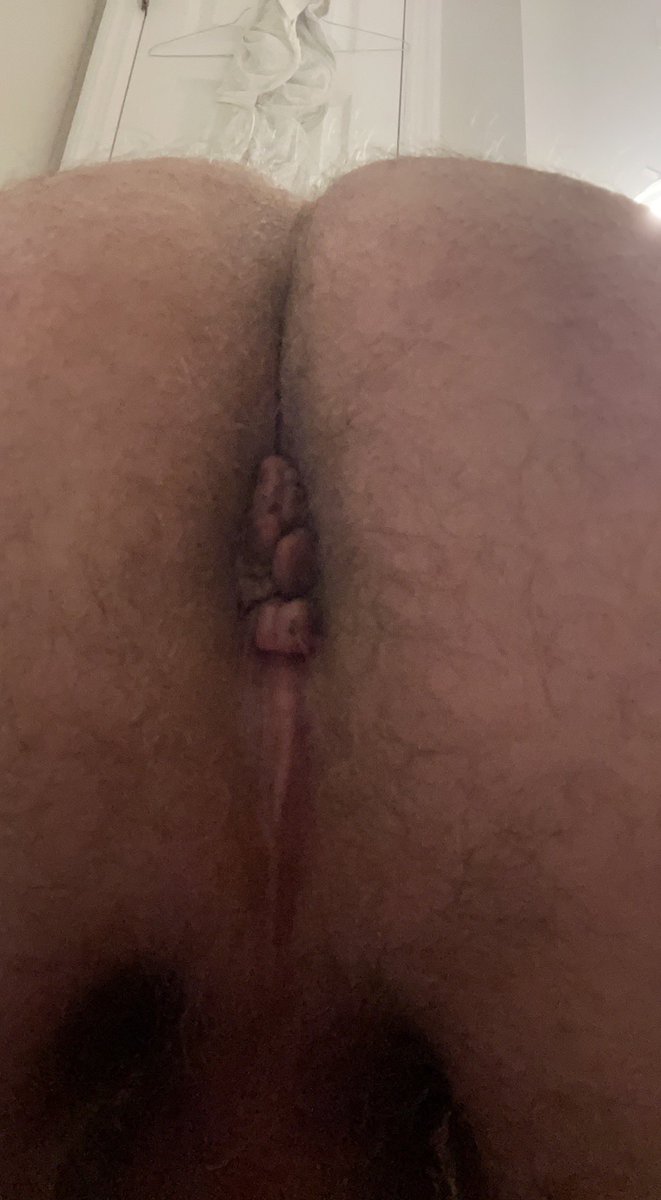 Tiny Dick Fag tweet media