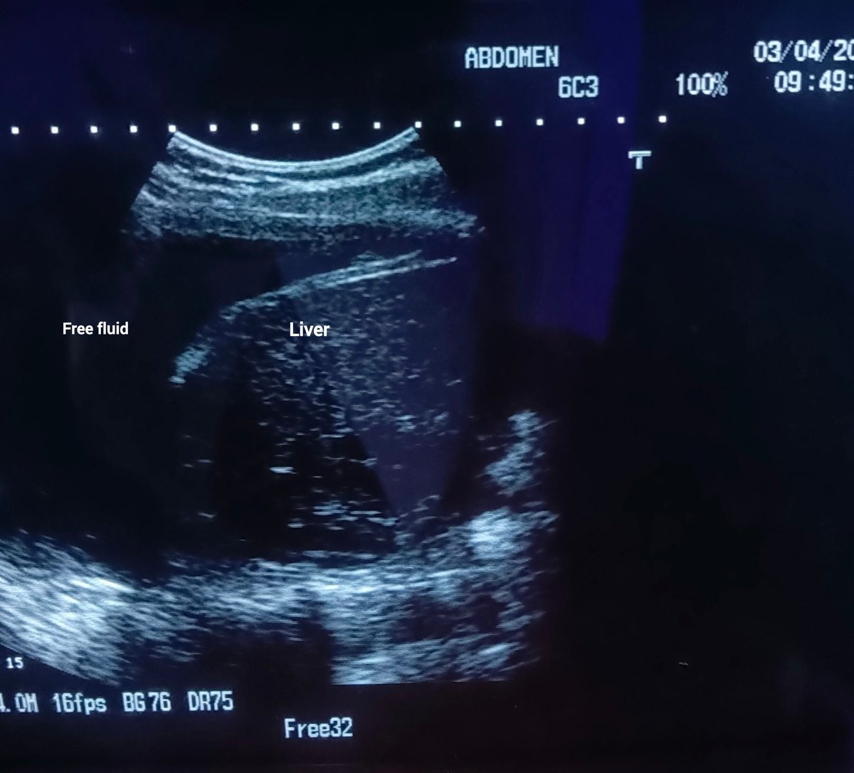 ChroRadGirlie tweet media