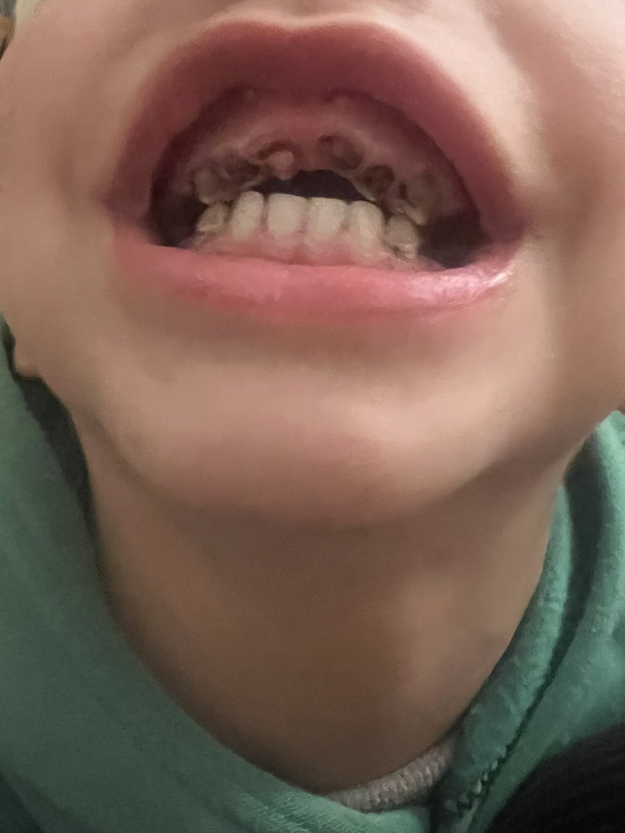 hala from Gaza 🇵🇸🍉 tweet media