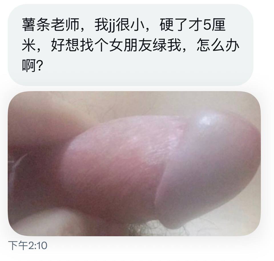 小薯条哭唧唧 tweet media