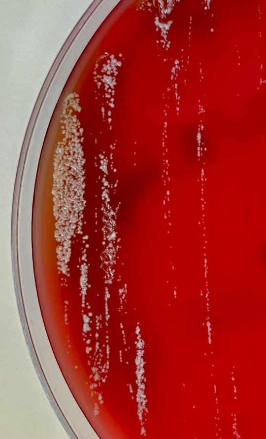 📸Foto de la semana:

🦠Cutibacterium acnes
🧫Aislado en 3/3 muestras (prótesis de hombro)
💄Identificación: MALDI-TOF

💡No todo es contaminación: en el contexto adecuado, patógeno relevante. Interpretar con clínica y número de muestras positivas.
