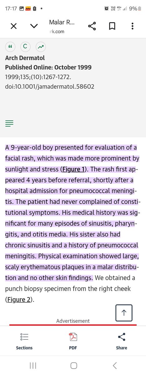 <a href="/Mota55em/">Dr Motasem Al-Gradey</a> <a href="/IhabFathiSulima/">Dr Ihab Suliman</a> Please check this ref in @JAMA if you have an access, it is a description of a typical malar rash associated to a streptococcus pneumoniae