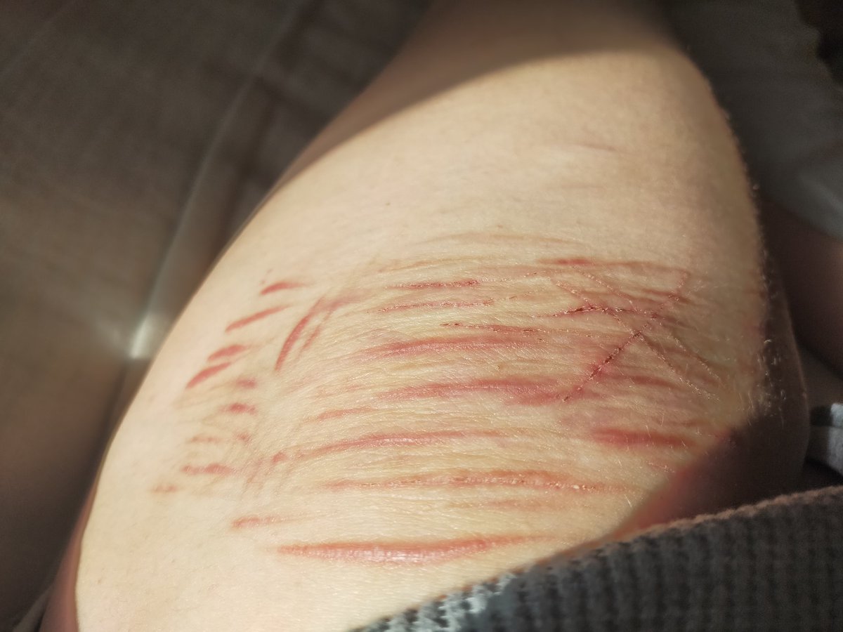 𝑅𝑒𝓂!!🐇## shedtwt tweet media