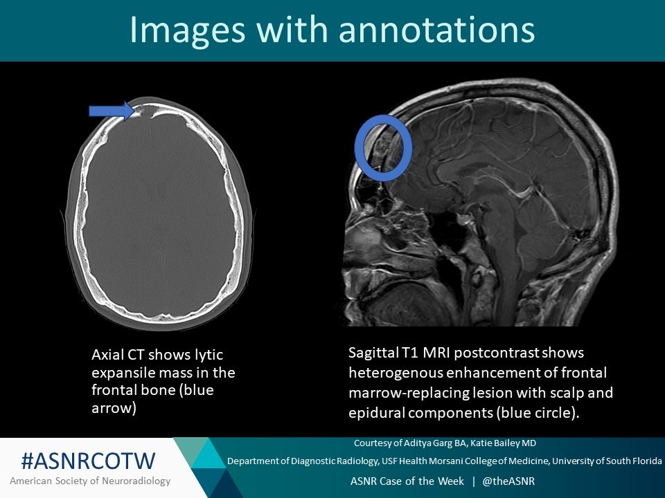 The American Society of Neuroradiology tweet media
