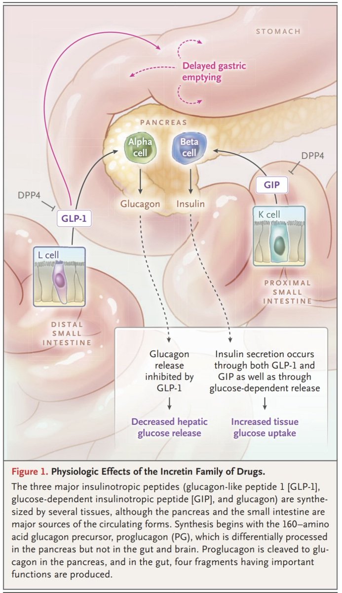 javier20ch's tweet photo. Agonistas del receptor GLP-1. 🫀💊
✨️Excelente revisión con todo lo qje hay saber del tema @NEJM 💯🧐✍️🏻
🟠Los arGLP-1 representan una de las mayores revoluciones terapéuticas recientes en DM2 y obesidad. Son análogos de incretinas que estimulan la secreción de insulina dependiente de glucosa, inhiben el glucagón, retrasan el vaciamiento gástrico y actúan a nivel central aumentando la saciedad, lo que se traduce en un potente efecto hipoglucemiante y pérdida de peso significativa. 
🟠Más allá del control metabólico, ensayos clínicos han demostrado beneficios CV y renales relevantes, incluyendo reducción de eventos CV mayores y enlentecimiento de la progresión de ERC, efectos que parecen ir más allá del simple control glucémico. 
🟠En términos de eficacia, reducen HbA1c hasta ~1.5–2% y logran pérdidas ponderales que pueden superar el 15–20% con moléculas de nueva generación como semaglutida o tirzepatida. 
🟠Sus efectos adversos son principalmente gastrointestinales (náusea, vómito, diarrea), generalmente transitorios, aunque existen preocupaciones sobre pérdida de masa magra, enfermedad biliar y la necesidad de tratamiento continuo para evitar la recuperación del peso. 

📄🆓️⤵️
DOI: 10.1056/NEJMra2500106
https://t.co/dTjsaVHAmg