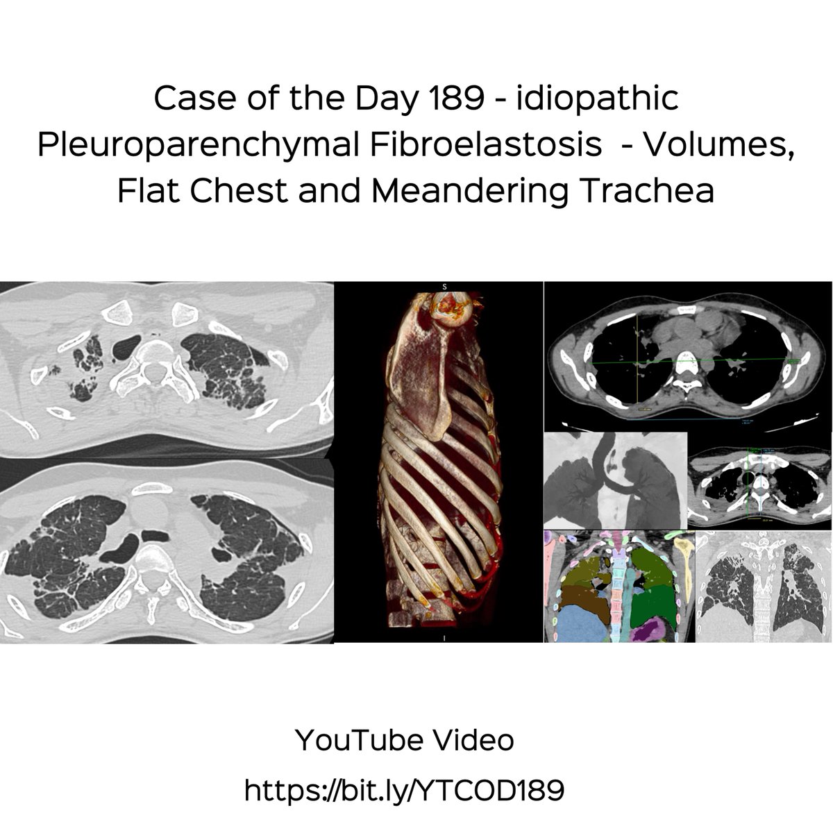 Bhavin Jankharia tweet media