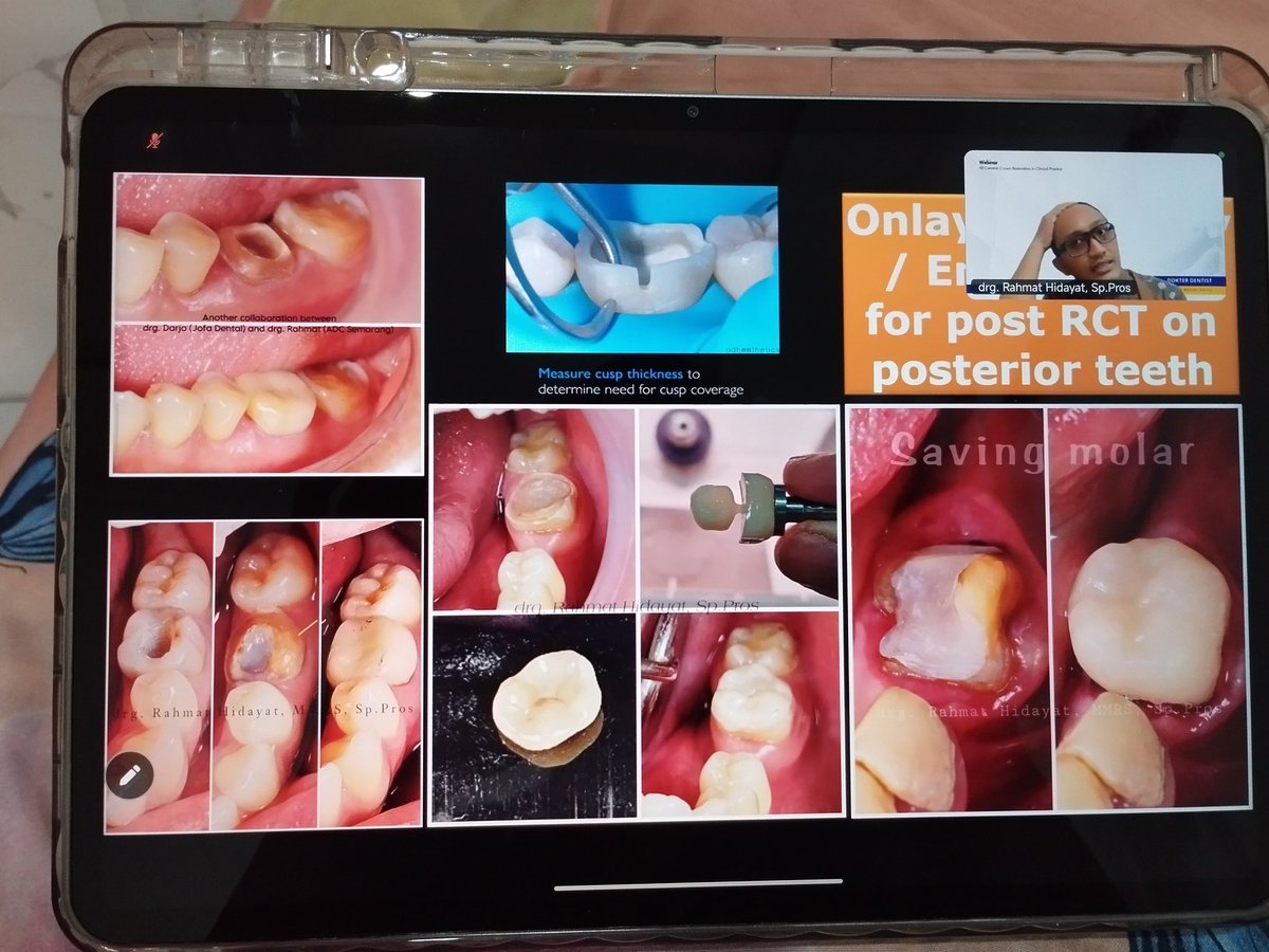 rahmandbd's tweet photo. kalo jadi pindah semarang, kayaknya menarik bisa kerja di kliniknya belio yg ada cad cam nya. ato bisa punya klinik cad cam sendiri? bahaha #manifesting https://t.co/SDJdnY2XAm