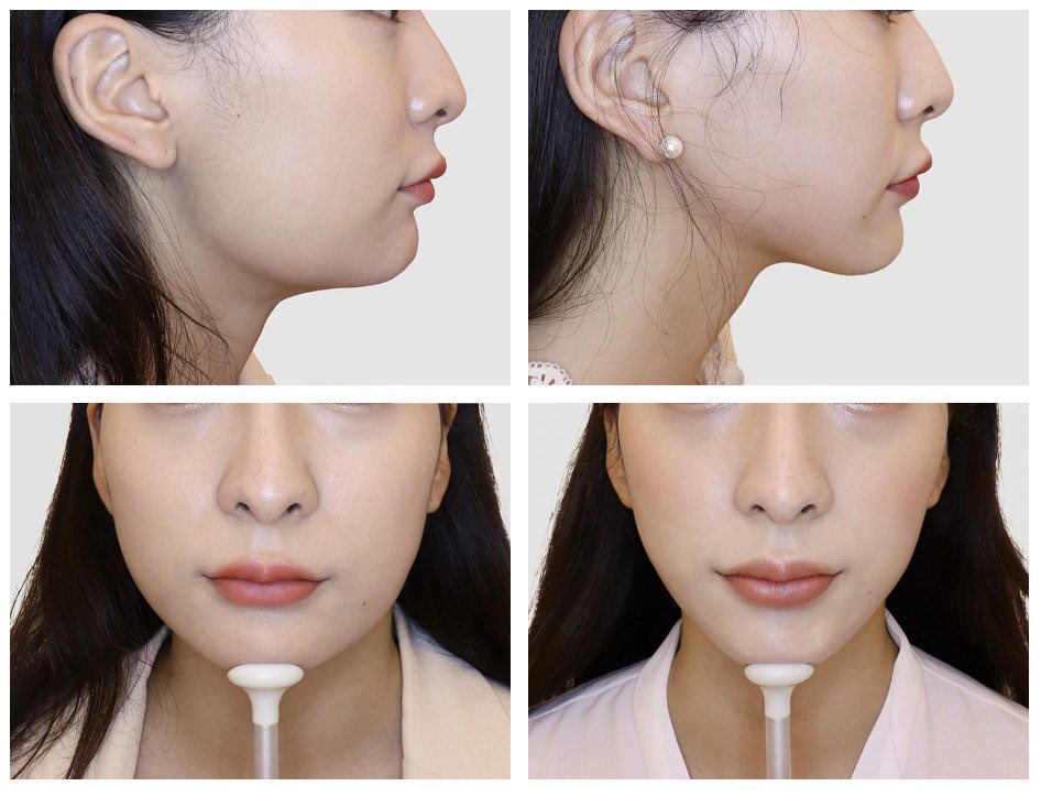 さらさ tweet media